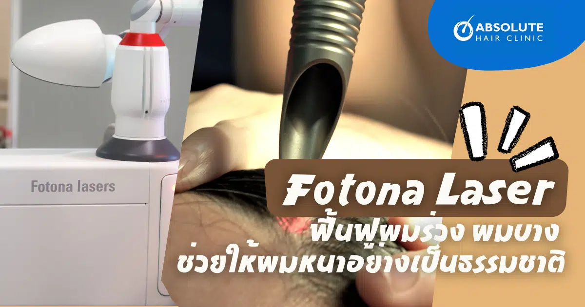 โฟโตน่าเลเซอร์ Fotona Laser
